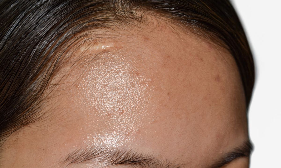 benefits of moisturizer for oily skin