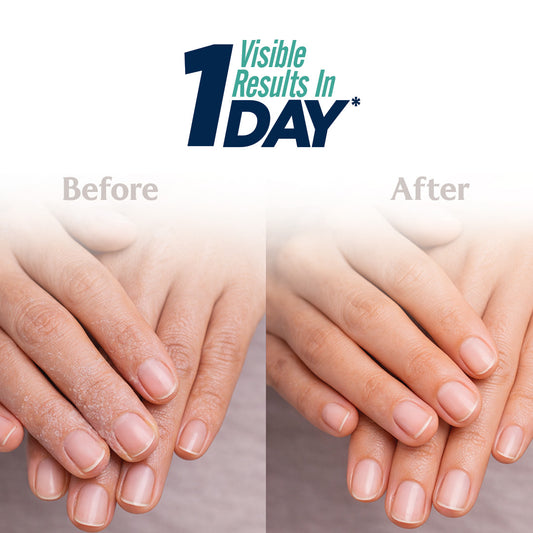 Pheet Dry Skin Cream