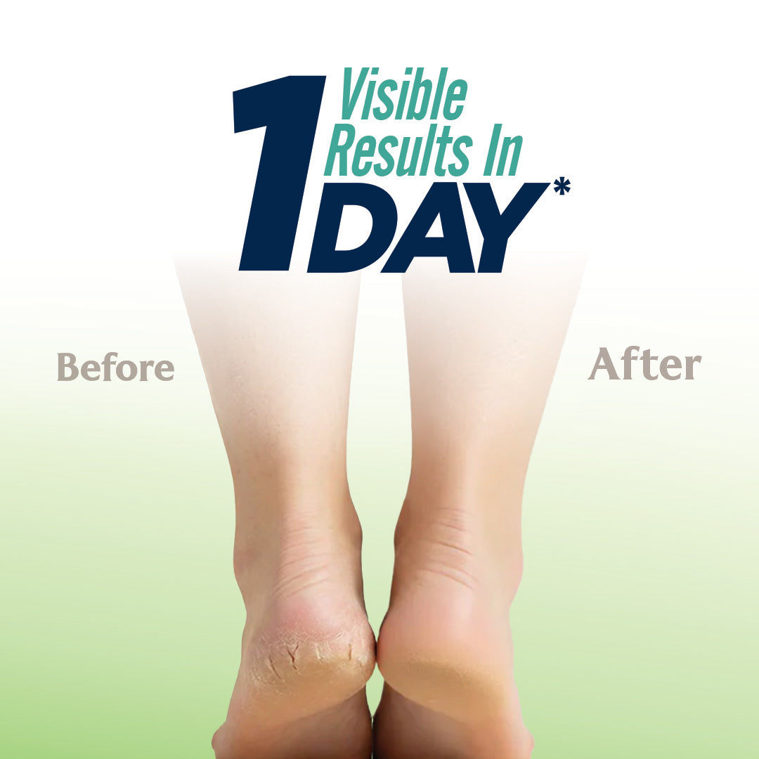Pheet Cracked Heel Balm with Manuka Honey