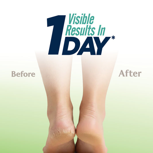 Pheet Cracked Heel Balm with Manuka Honey