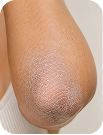 Day 1 - Tightness eases | Skin care